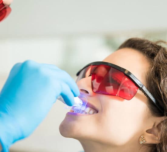 Ultraviyole ışıkla diş beyazlatma uygulaması
